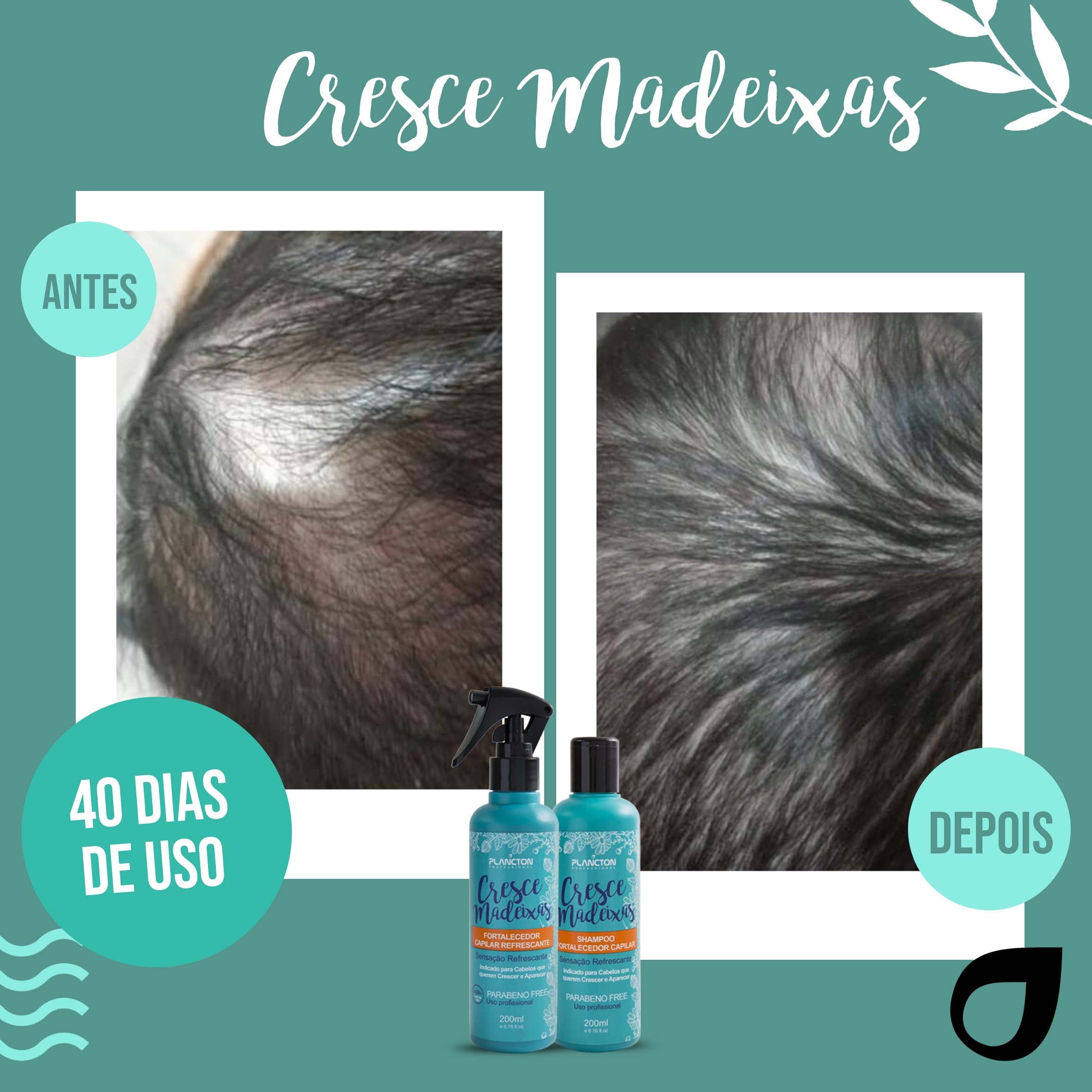 KIT CRESCE MADEIXAS PLANCTON - 200ml